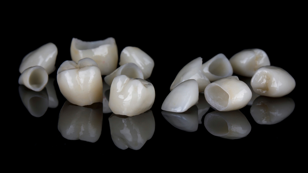 cerec same day crowns mesa